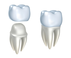 gevolg Dokter Veeg Behandelingen – Kliniek voor Tandheelkunde
